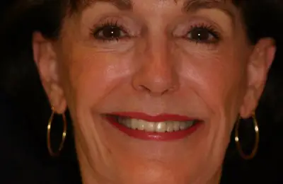 Smiling patient from Implant & Periodontics Solutions in Sun City West, AZ