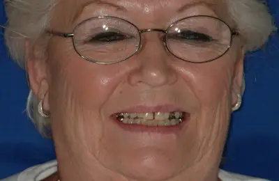 Smiling patient from Implant & Periodontics Solutions in Sun City West, AZ