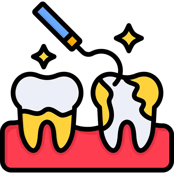 A cartoon-style illustration showing scaling and root planing done on a tooth