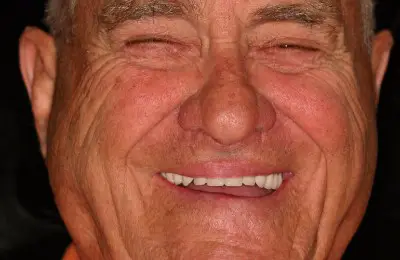 Patient smiling with Teeth-In-A-Day from Implant & Periodontics Solutions in Sun City West, AZ