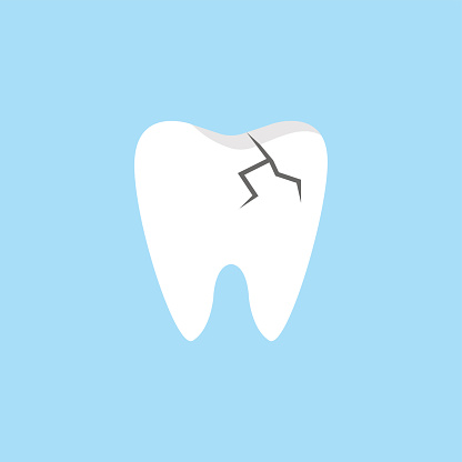 Illustration of a cracked tooth with a blue background